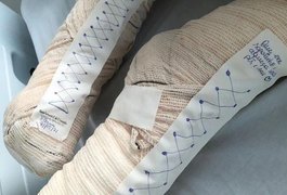 'Sapatinho' criado por enfermeira alagoana, para paciente da covid, comove na internautas