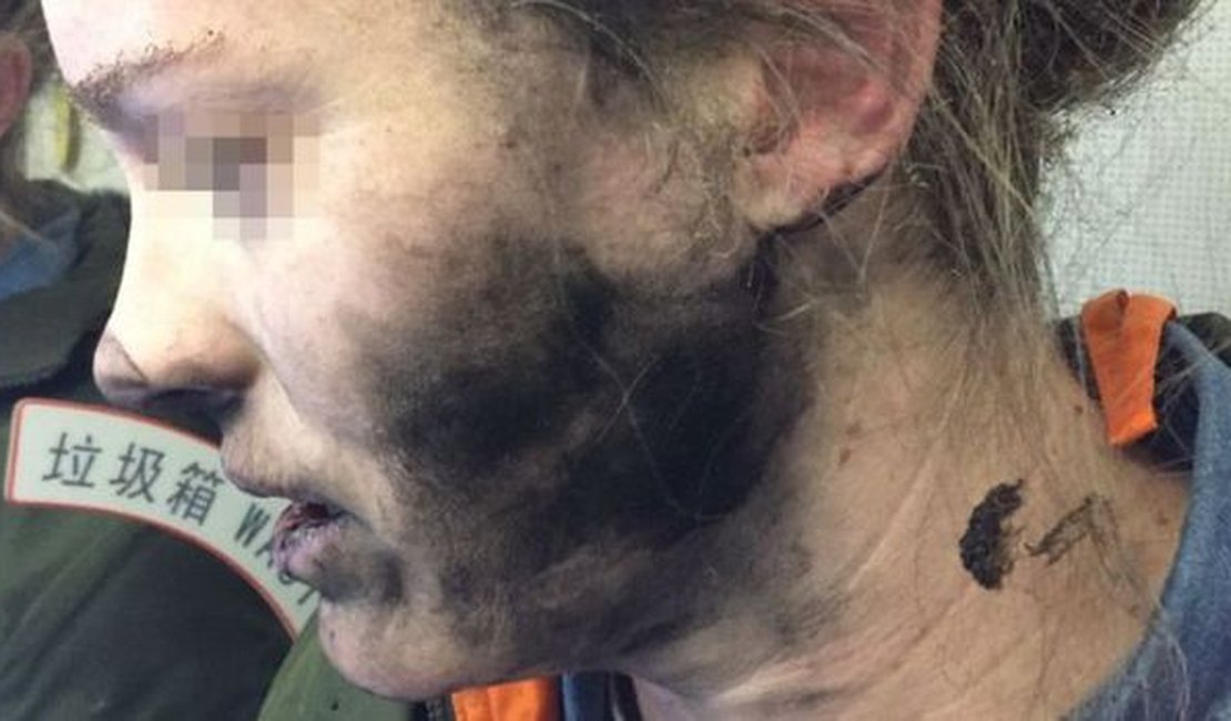 Fone de ouvido explode durante voo e deixa passageira ferida