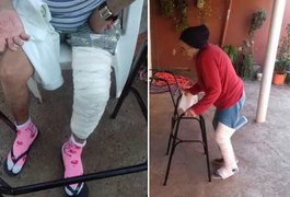 Idosa se machuca e tem a perna enfaixada por cima da calça e do tênis