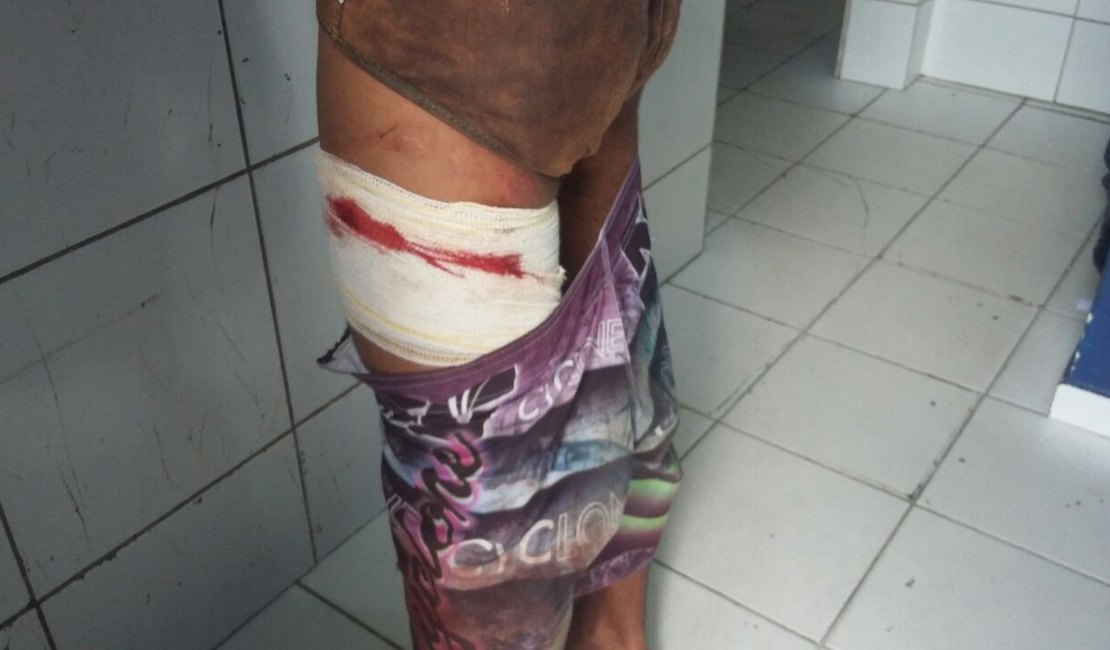 Adolescente suspeito de assalto atira na própria coxa