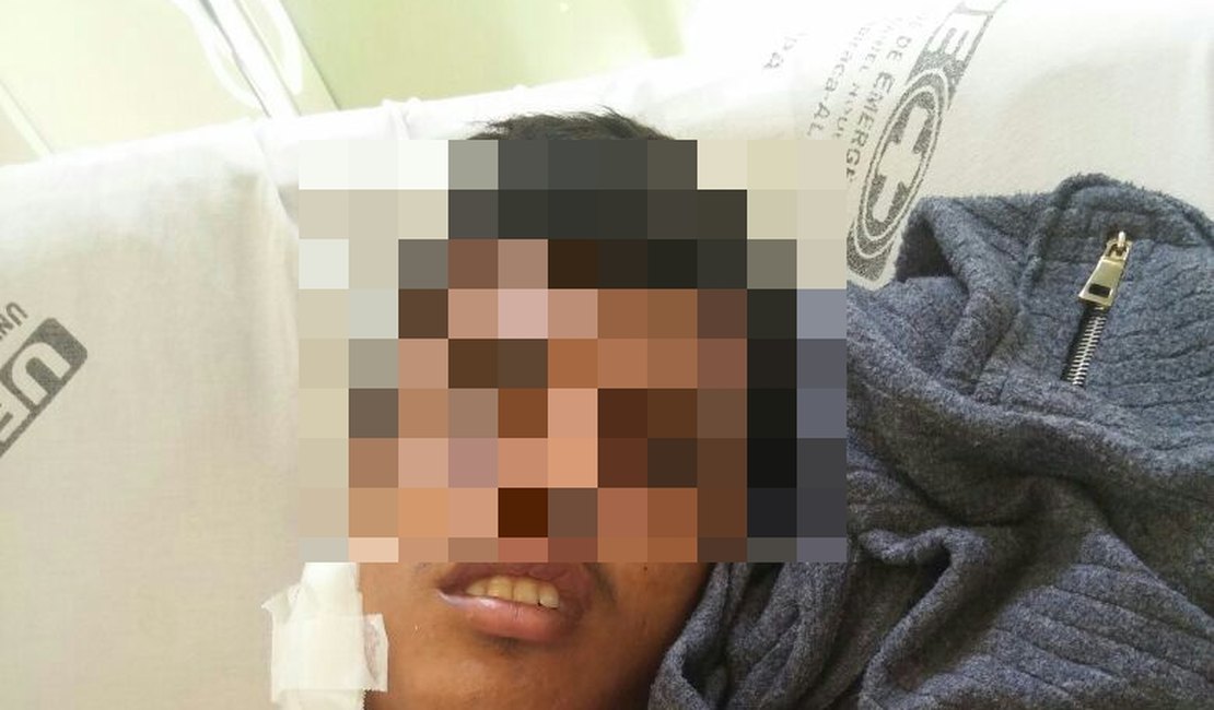 Menor suspeito de assalto a Caixa Aqui em Santana do Ipanema está internado na UEA