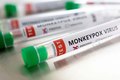 Nariz de homem com varíola dos macacos apodrece antes de diagnóstico