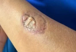 Mãe de aluno morde vice-diretora e funcionários de escola após discussão por uso de uniforme, diz TV