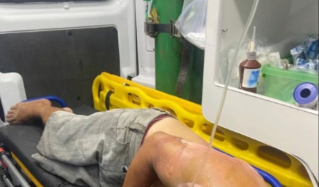 Com o corpo em chamas, homem acusa esposa de tentativa de homicídio