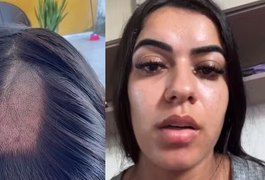 Mulher denuncia clínica após ter cabelo raspado em exame toxicológico para CNH