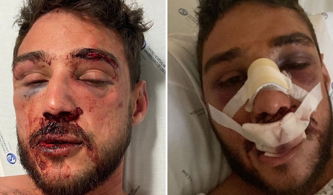 Bar em Lisboa diz que vai 'apurar responsáveis' pela agressão de alagoano e namorado