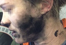 Fone de ouvido explode durante voo e deixa passageira ferida