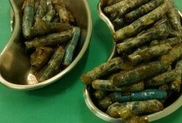 Preso faz cirurgia para retirar quase 1 kg de maconha do estômago