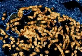 OMS declara surto de ebola na África: “Emergência global”