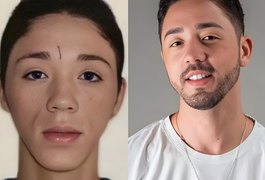 Rico Melquíades é barrado em Dubai após fazer harmonização facial