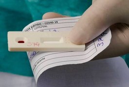 Covid-19: Arapiraca tem aumento de casos confirmados nos últimos dias