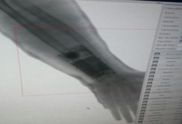 Vídeo. Dupla e presa por tentar fraudar concurso da PM em Sergipe