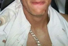 Goleiro alagoano fica ferido durante assalto em Marechal Deodoro