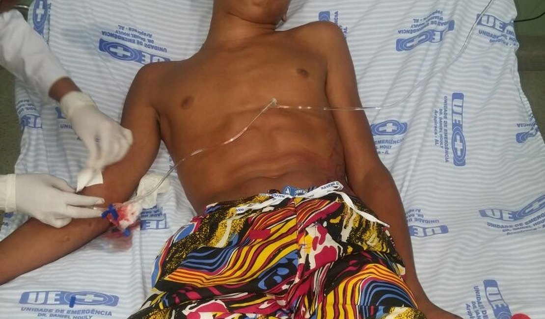 Menor é alvejado a tiros no bairro Bonsucesso, em Arapiraca