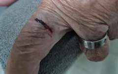 Idosa foi agredida por sobrinha que é médica, em Arapiraca