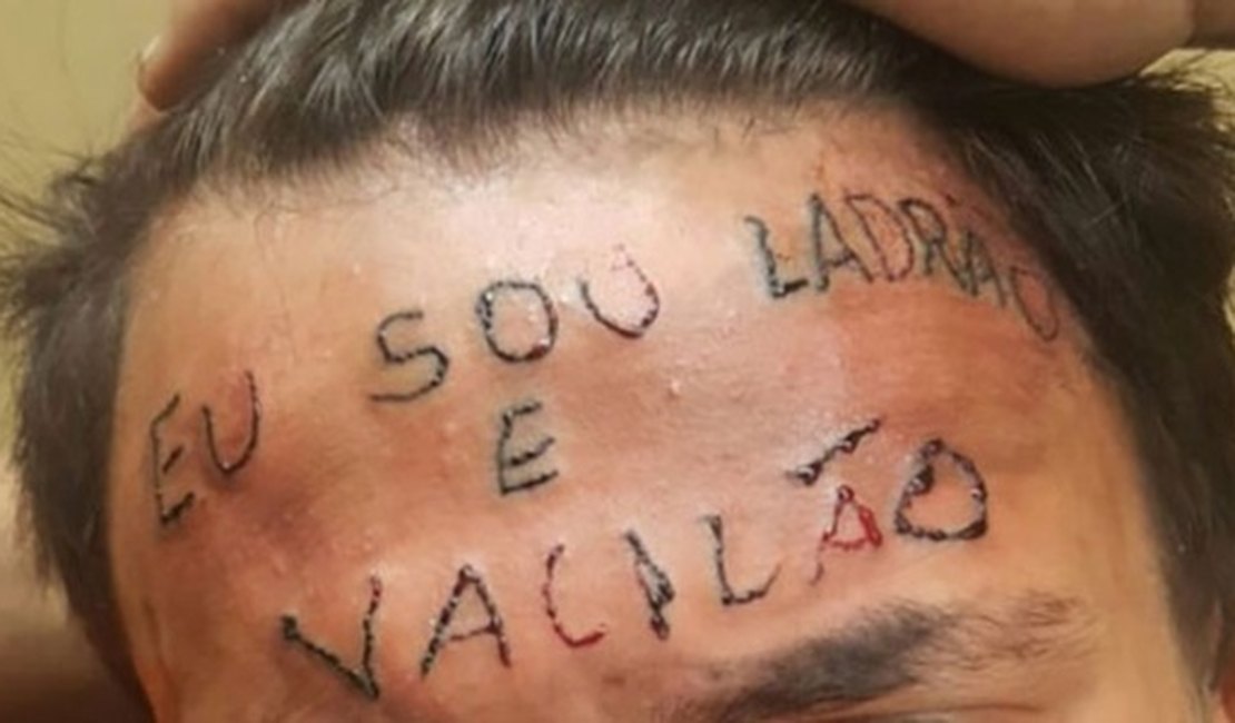 Campanha arrecada quase R$ 20 mil para apagar tatuagem da testa de adolescente