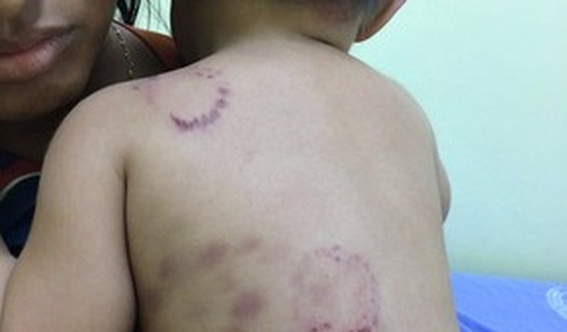 Bebê é hospitalizado com marcas de mordida e mãe depõe à polícia no AM