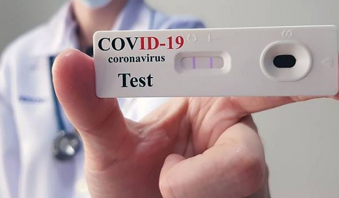 Cai para 36 números de novos infectados pelo coronavírus nas últimas 24 horas