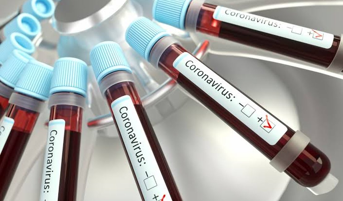 Brasil registra 72.833 mortes de covid-19 e 1.884.967 casos confirmados