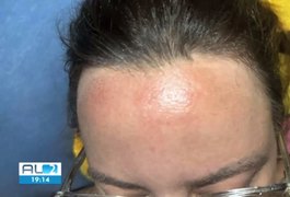 Associei ao calor', diz maquiadora com queimadura na testa após unção com óleo em igreja em Maceió