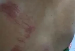 Com ciúmes, homem dá soco em companheira e tenta matá-la estrangulada em Piaçabuçu