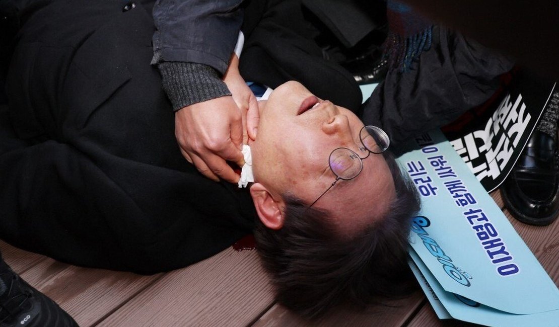 Político esfaqueado na Coreia do Sul se recupera depois de cirurgia