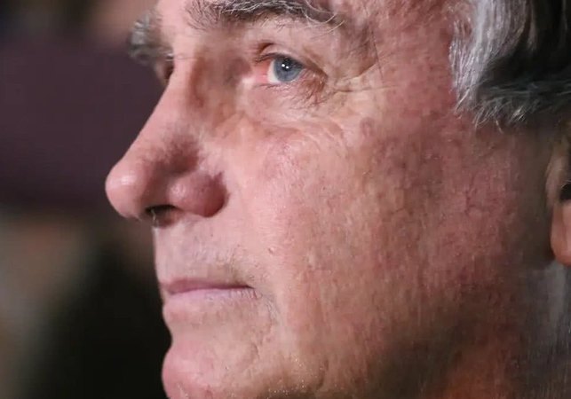 Cirurgia em ombro de Bolsonaro é concluída sem intercorrências, diz boletim médico