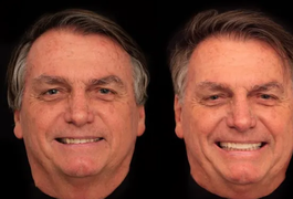 Bolsonaro faz harmonização e coloca lentes; veja antes e depois