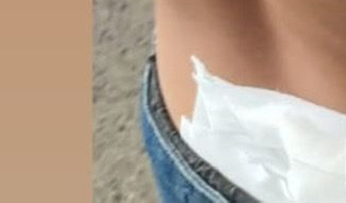 Criança que levou tiro nas costas ao pegar manga em Batalha fala sobre o caso