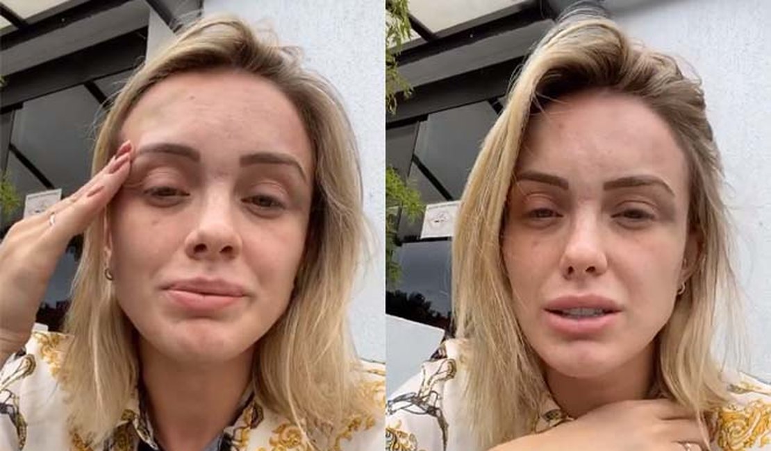 Às vésperas do casamento, Monick Camargo diz que foi agredida pelo noivo