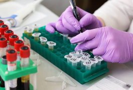 OMS confirma caso de influenza A H1N2, com potencial pandêmico, no Brasil