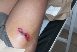 Homens encapuzados atiram contra adolescente na zona rural de Girau do Ponciano