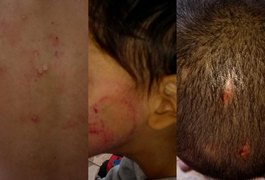 Crianças de 4, 7 e 11 anos vítimas de tortura são resgatadas da casa do tio