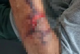 Mulher suspeita de espancar idoso e roubar R$ 10 mil é presa em Delmiro Gouveia