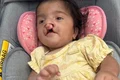 Família de bebê alagoana com malformações congênitas promove rifa para custear tratamento de saúde