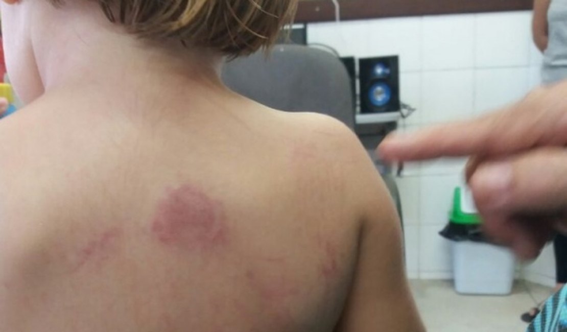 Criança é deixada em creche de Maceió e volta pra casa com marcas de violência