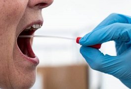 Com 90% de eficácia, SWAB será disponibilizado em Arapiraca para testagem de Covid-19