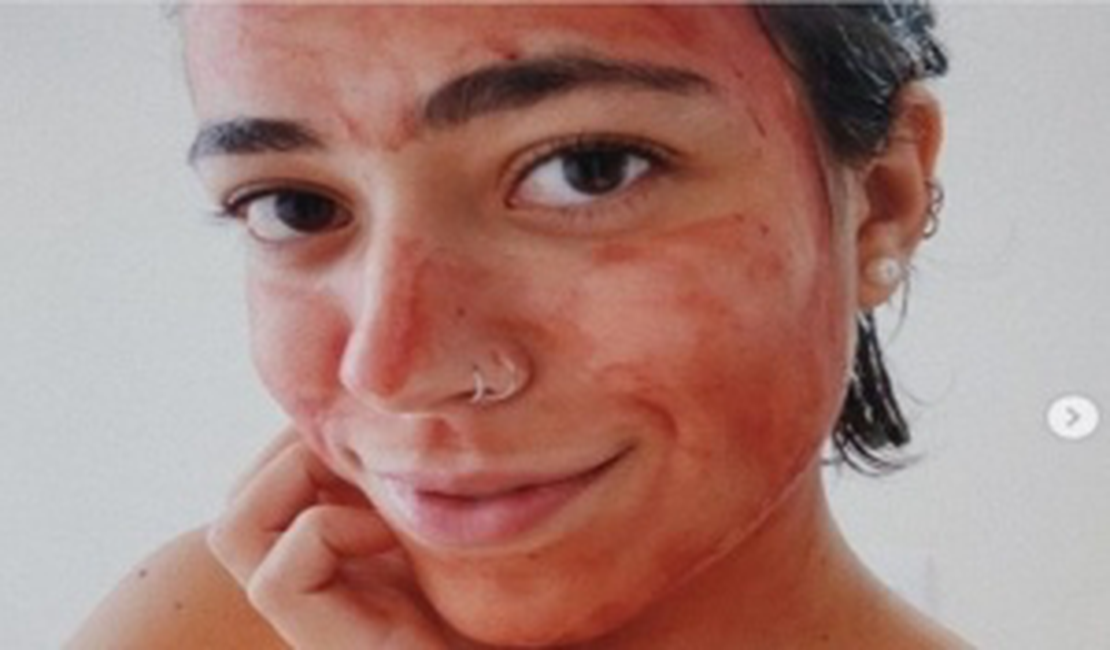 Blogueira recomenda sangue da menstruação como máscara facial: 'Pele de bebê'