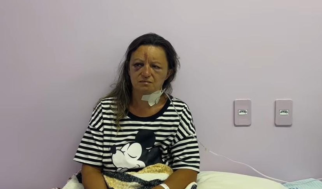 VÍDEO: Mulher estuprada e espancada em Palmeira dos Índios conta que foi enforcada até perder os sentidos