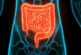 SUS passa a oferecer teste de fezes para rastrear câncer de intestino