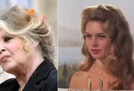Brigitte Bardot, de 91 anos, é internada em estado grave e passa por cirurgia na França