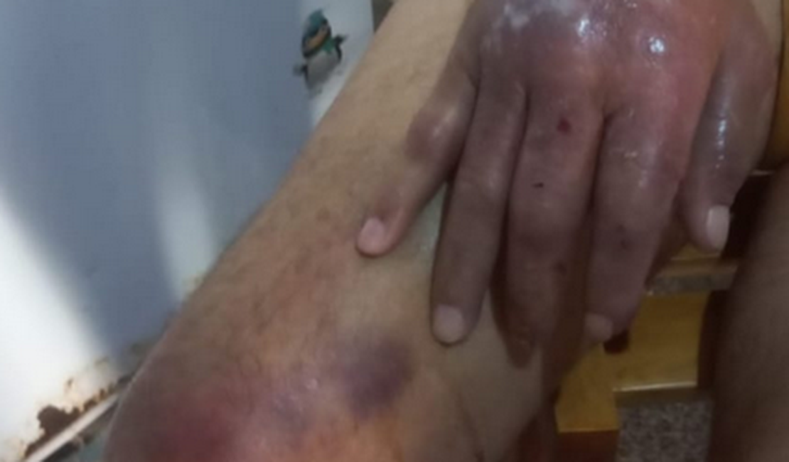 Belo Monte: Mulher é presa por omissão de socorro e maus-tratos contra o próprio pai, de 84 anos