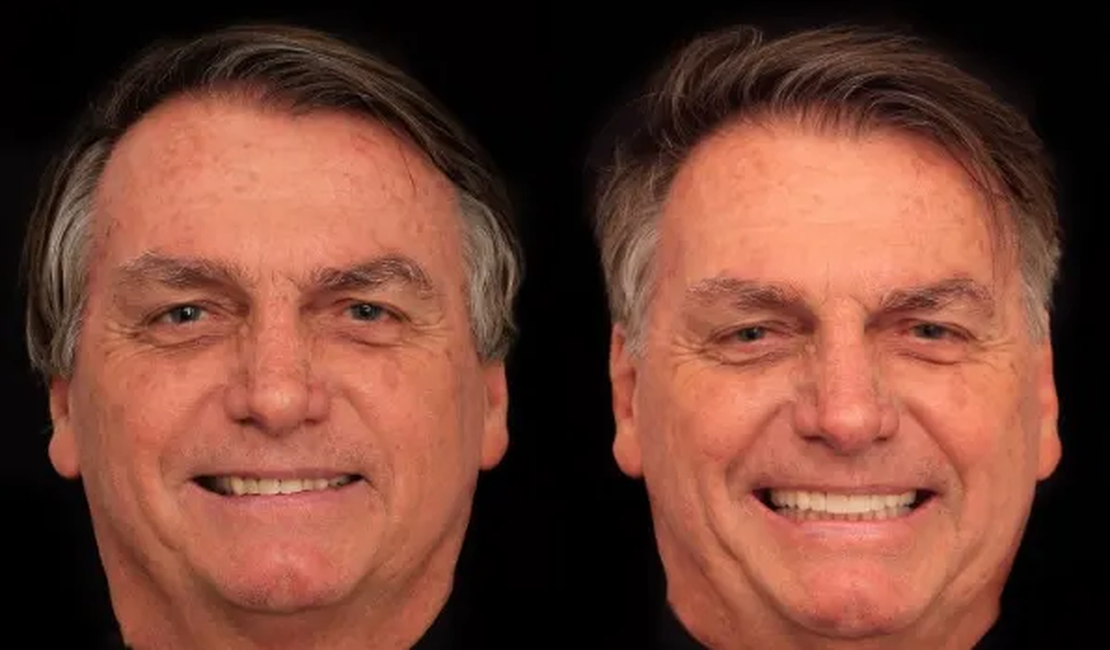 Bolsonaro faz harmonização e coloca lentes; veja antes e depois