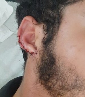 Garçom tem parte da orelha arrancada após mordida durante confusão em lanchonete no Sertão
