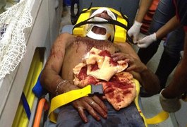 Agredido pelo próprio pai, jovem é socorrido para a Unidade de Emergência