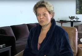 Joice Hasselmann apresenta 5 fraturas no rosto, diz não saber o que houve e aciona Polícia Legislativa