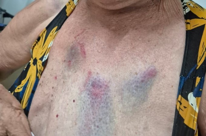 Médica é presa duas vezes em flagrante por agredir idosa de 77 anos em Arapiraca