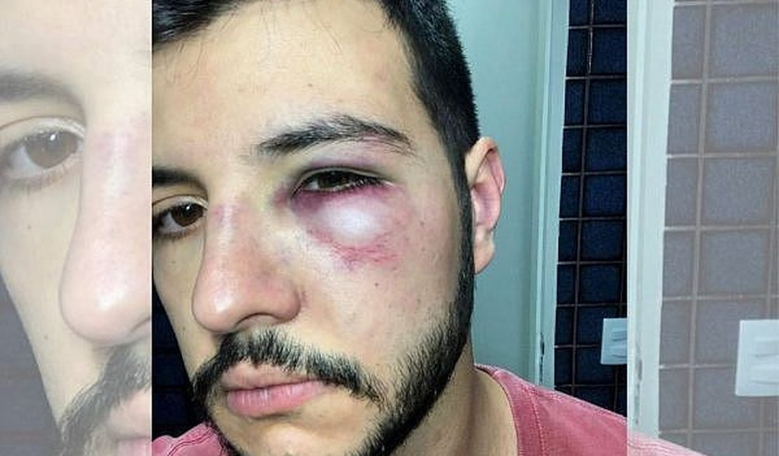 Jornalista, apresentador da TV Record é agredido após reagir a assalto