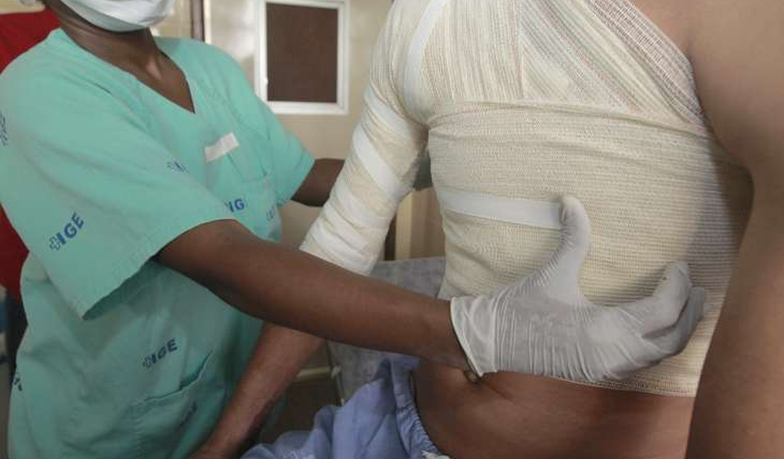 Homem é atraído para encontro por aplicativo e tem corpo queimado em Maceió