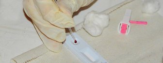 Sesau abre inscrições para o Curso sobre as Diretrizes de Diagnóstico do HIV, Hepatites e Sífilis